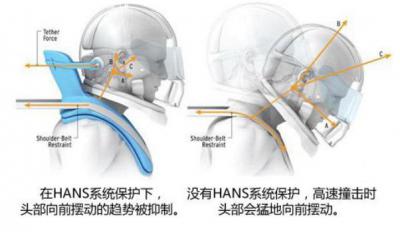 头颈保护系统HANS,固定保护(更安全)